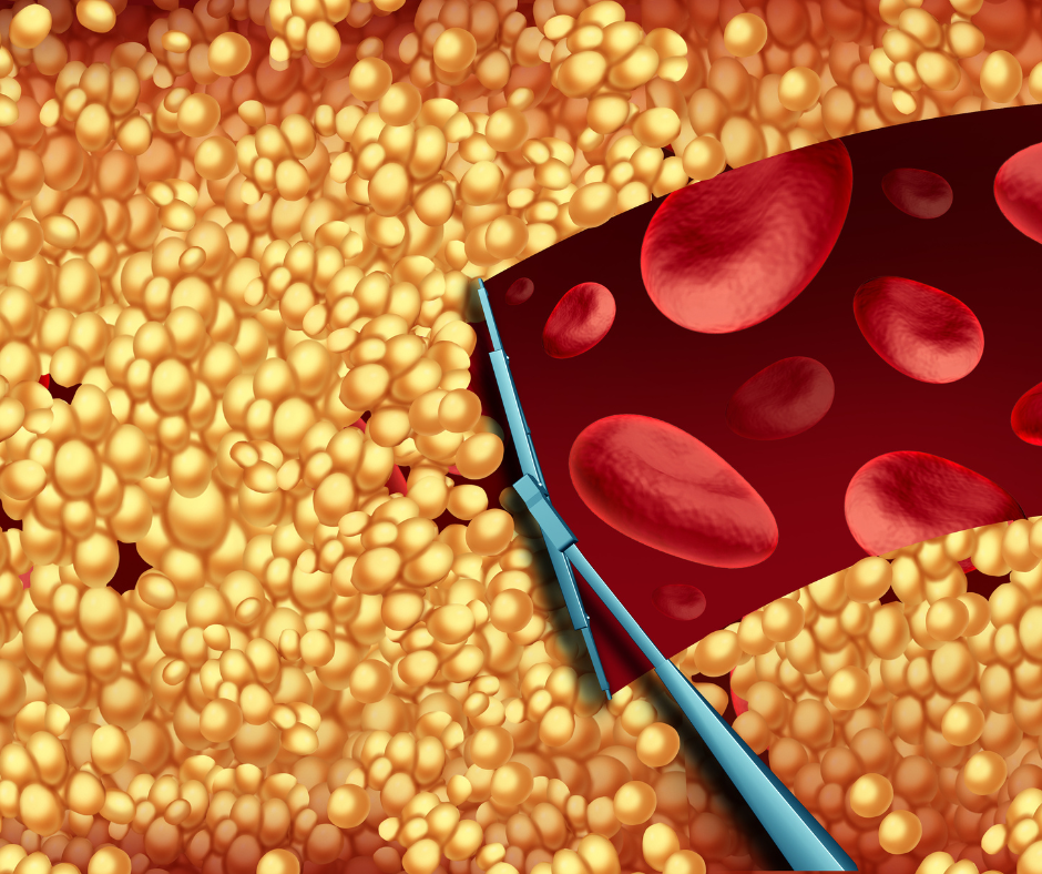 Coq10 For Statins Benefits And Dosage Recommendations Coq10 For Statins Benefits And Dosage Recommendations